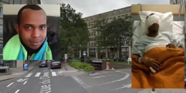 Photo: African man brutally attacked in Brussels, his eyes gouged out